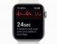 Apple Watch saa laajennetun palautuskäytännön sydämen terveysominaisuuksista