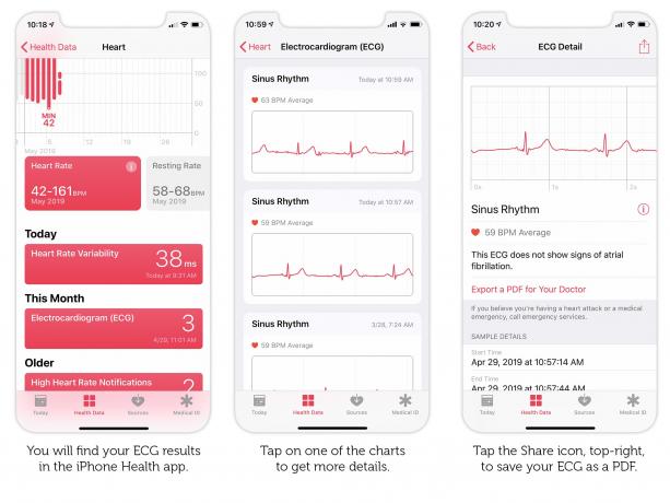 Kako izvesti rezultat EKG -a za Apple Watch kao PDF koji ćete pokazati svom liječniku