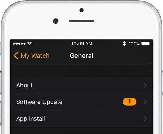 „Apple Watch“ programinės įrangos atnaujinimai atliekami jūsų „iPhone“.